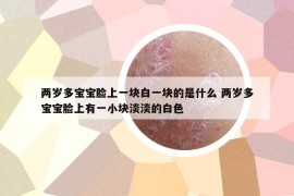 兩歲多寶寶臉上一塊白一塊的是什么 兩歲多寶寶臉上有一小塊淡淡的白色