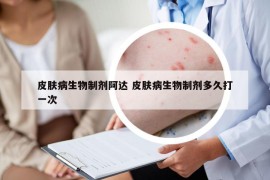 皮膚病生物制劑阿達 皮膚病生物制劑多久打一次