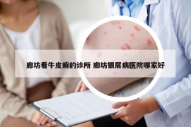 廊坊看牛皮癬的診所 廊坊銀屑病醫(yī)院哪家好