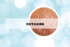 河南專治白癲瘋