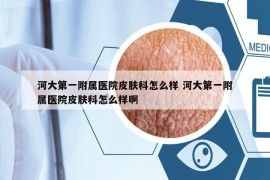 河大第一附屬醫(yī)院皮膚科怎么樣 河大第一附屬醫(yī)院皮膚科怎么樣啊