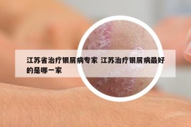 江蘇省治療銀屑病專家 江蘇治療銀屑病最好的是哪一家