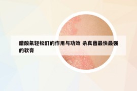 醋酸氟輕松酊的作用與功效 殺真菌最快最強的軟膏