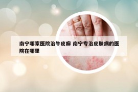南寧哪家醫(yī)院治牛皮癬 南寧專治皮膚病的醫(yī)院在哪里