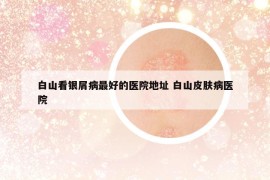 白山看銀屑病最好的醫(yī)院地址 白山皮膚病醫(yī)院