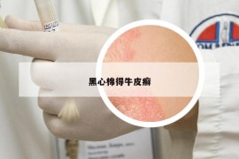 黑心棉得牛皮癬