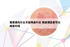 銀屑病為什么不能喝桑葉水 銀屑病患者可以喝茶葉嗎