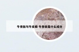 牛骨肽與牛皮癬 牛骨肽是什么成分