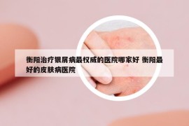 衡陽(yáng)治療銀屑病最權(quán)威的醫(yī)院哪家好 衡陽(yáng)最好的皮膚病醫(yī)院