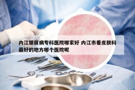 內(nèi)江銀屑病專科醫(yī)院哪家好 內(nèi)江市看皮膚科最好的地方哪個(gè)醫(yī)院呢