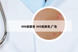 999皮膚膏 999皮膚膏,廣告