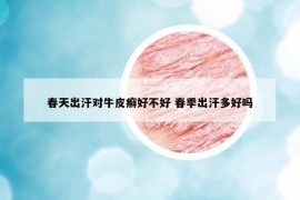 春天出汗對牛皮癬好不好 春季出汗多好嗎