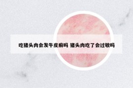 吃豬頭肉會(huì)發(fā)牛皮癬嗎 豬頭肉吃了會(huì)過敏嗎