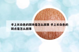 手上長白色的斑塊是怎么回事 手上長白色的斑點(diǎn)是怎么回事
