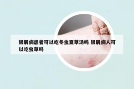 銀屑病患者可以吃冬蟲夏草湯嗎 銀屑病人可以吃蟲草嗎