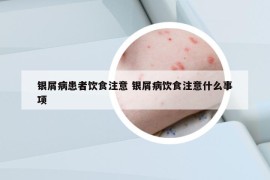 銀屑病患者飲食注意 銀屑病飲食注意什么事項