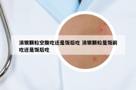 消銀顆?？崭钩赃€是飯后吃 消銀顆粒是飯前吃還是飯后吃