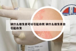 缺什么維生素可以引起白斑 缺什么維生素會引起白發(fā)