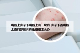 嘴唇上鼻子下嘴唇上有一塊白 鼻子下面嘴唇上面的部位長(zhǎng)白色痘痘怎么辦