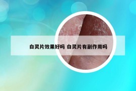 白靈片效果好嗎 白靈片有副作用嗎
