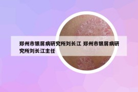 鄭州市銀屑病研究所劉長(zhǎng)江 鄭州市銀屑病研究所劉長(zhǎng)江主任