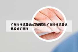 廣州治療銀屑病的正規(guī)醫(yī)院 廣州治療銀屑病比較好的醫(yī)院