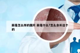 蘚是怎么樣的圖片 蘚是什么?怎么會長這個的
