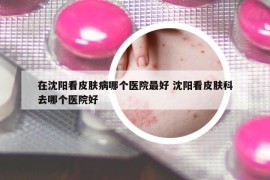 在沈陽看皮膚病哪個醫(yī)院最好 沈陽看皮膚科去哪個醫(yī)院好