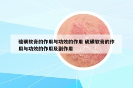 硫磺軟膏的作用與功效的作用 硫磺軟膏的作用與功效的作用及副作用