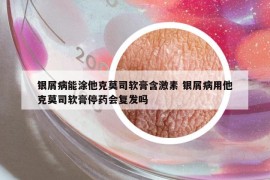 銀屑病能涂他克莫司軟膏含激素 銀屑病用他克莫司軟膏停藥會(huì)復(fù)發(fā)嗎
