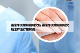 南京華夏銀屑病研究所 南京華夏銀屑病研究所怎樣治療銀屑病
