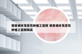 銀屑病并發(fā)惡性腫瘤乙亞胺 銀屑病并發(fā)惡性腫瘤乙亞胺酶高