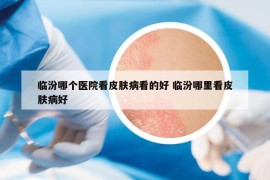 臨汾哪個醫(yī)院看皮膚病看的好 臨汾哪里看皮膚病好