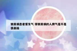 銀屑病患者愛生氣 得銀屑病的人脾氣是不是很暴躁