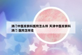 津門中醫(yī)皮膚科醫(yī)院怎么樣 天津中醫(yī)皮膚科津門 醫(yī)院怎樣走