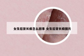 女生后背長癬怎么回事 女生后背長癬圖片