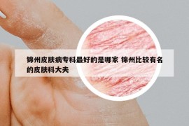 錦州皮膚病?？谱詈玫氖悄募?錦州比較有名的皮膚科大夫