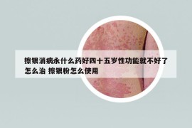 擦銀消病永什么藥好四十五歲性功能就不好了怎么治 擦銀粉怎么使用