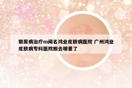 銀屑病治療m聞名鴻業(yè)皮膚病醫(yī)院 廣州鴻業(yè)皮膚病專科醫(yī)院搬去哪里了