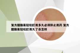 復(fù)方醋酸氟輕松酊用多久必須停止用藥 復(fù)方醋酸氟輕松酊用久了會怎樣