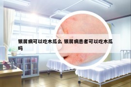 銀屑病可以吃木瓜么 銀屑病患者可以吃木瓜嗎