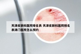 天津皮膚科醫(yī)院排名表 天津皮膚科醫(yī)院排名表津門醫(yī)院怎么預(yù)約