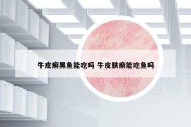 牛皮癬黑魚能吃嗎 牛皮膚癬能吃魚嗎