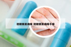 初期銀屑病癢 初期銀屑病癢不癢