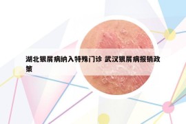 湖北銀屑病納入特殊門診 武漢銀屑病報銷政策