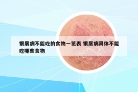 銀屑病不能吃的食物一覽表 銀屑病具體不能吃哪些食物