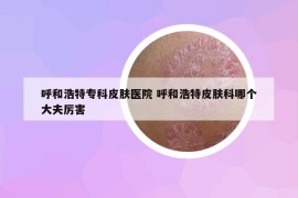 呼和浩特?？破つw醫(yī)院 呼和浩特皮膚科哪個大夫厲害