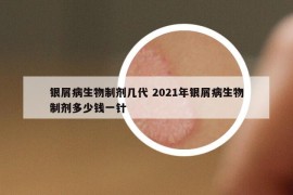 銀屑病生物制劑幾代 2021年銀屑病生物制劑多少錢一針