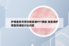 護(hù)理查房尋常性銀屑病PPT模板 銀屑病護(hù)理查房課后討論問題