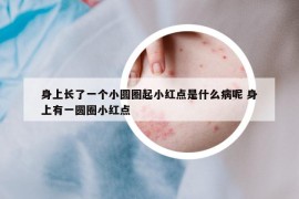 身上長(zhǎng)了一個(gè)小圓圈起小紅點(diǎn)是什么病呢 身上有一圓圈小紅點(diǎn)